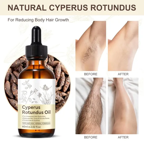 Vista 4 de NIFEISHI Aceite Cyperus Rotundus para depilación, fórmula natural para reducir el crecimiento del vello corporal no deseado, reducir los poros
