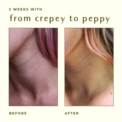 Vista 2 de AYADARA Crepey Skin Repair Cream 8oz, loción reafirmante para piel suelta, crema de colágeno corrector de crepé para tensar el cuerpo, crema