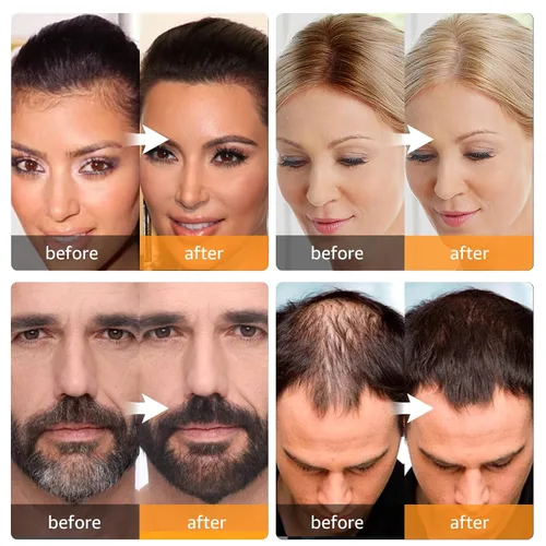 Vista 2 de Retoque de Raíz Instantáneo Polvo de Cobertura de Canas, Oculta la Pérdida de Cabello y Adelgazamiento Para Mujeres y Hombres, Fibras Capilares