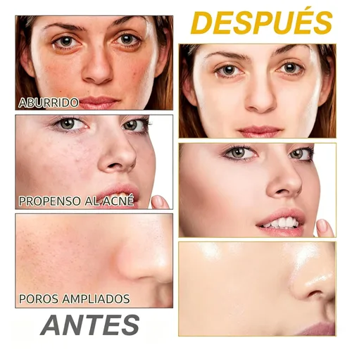 Vista 8 de Almohadillas limpiadoras de cúrcuma y ácido kójico, 20 unidades, manzanilla para manchas oscuras, tono de piel uniforme, almohadillas faciales