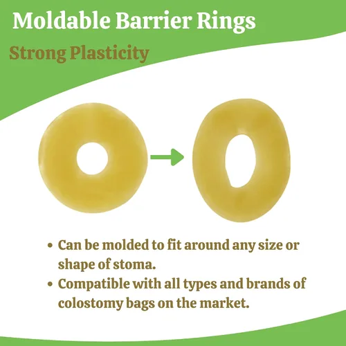 Vista 5 de 10 anillos elásticos moldeables de barrera para ostomía, 2 pulgadas de diámetro, 0.157 in de grosor, sin fugas, anillo extensor de sello