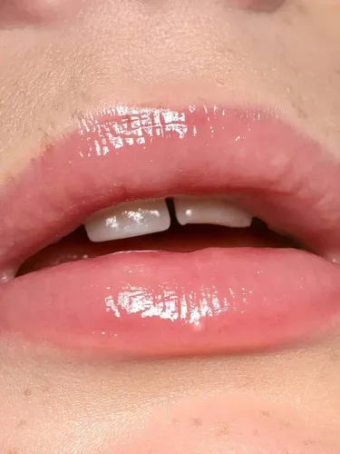 Vista 2 de REFY Brillo de labios - Blush (rosa claro, neutro) + mascarilla hidratante coreana prémium