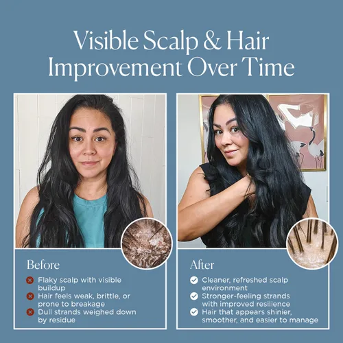 Vista 6 de Champú de ajo para tratamiento capilar. Para cabello normal a seco 32 onzas.