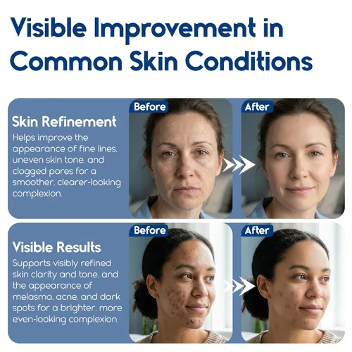 Vista 5 de Almohadillas de ácido glicólico al 35% - Almohadillas de rejuvenecimiento para rostro y cuerpo - Almohadilla exfoliante para cuerpo, puntos negros