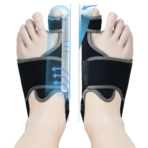 Vista 8 de MOONSMILE 1 par de correctores de juanetes de pies para mujeres y hombres, férula nocturna para juanetes, enderezador de dedo gordo para el pie