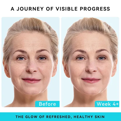 Vista 2 de Crema facial de retinol con colágeno y ácido hialurónico, hidratante facial antienvejecimiento y reafirmante para mujeres y hombres, crema de noche
