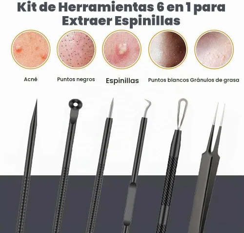 Vista 6 de Kit de herramientas para reventar espinillas, 6 piezas, removedor de espinillas, juego de herramientas de aguja para acné, tratamiento de Negro