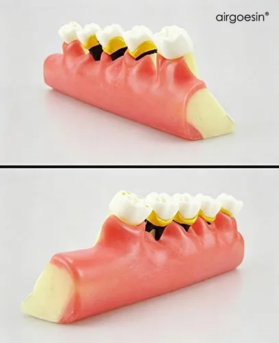 Vista 2 de Dental Periodontal Disease assort Dientes Dientes Typodont Estudio Modelo de Enseñanza Nuevo