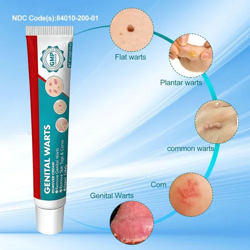 Vista 5 de Crema eliminadora de verrugas, crema para verrugas genitales, verrugas, verrugas plantares, verrugas comunes, maíz, Flat Wars NDC (84010-200-01)