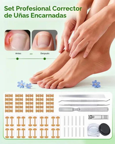 Vista 5 de Juego de corrector de uñas encarnadas con tiras correctoras, kit de eliminación de uñas encarnadas, parche corrector, herramientas de pedicura