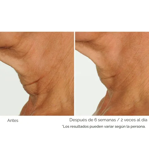Vista 3 de NassifMD Deco-Lift Neck & Decollete Firming & Lifting Complex