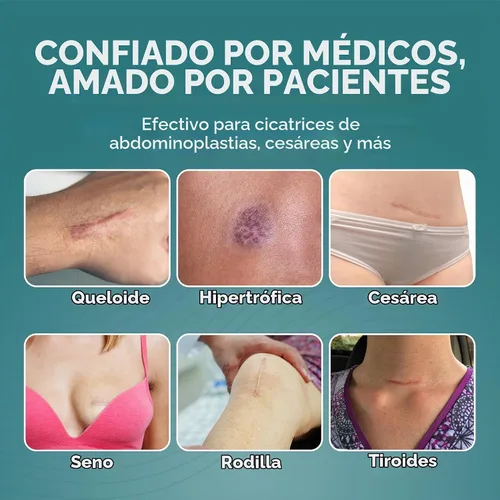 Vista 7 de Epiderm - Tiras de silicona para cicatrices, cinta de silicona reutilizable Transparente (paquete de 5)