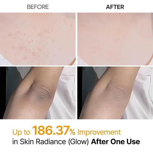 Vista 3 de Dr.Melaxin Cuidado de Queratina Corporal Ácido Kójico Cúrcuma Spray Exfoliante Suave Solución Peeling Cuidado de la Piel Coreano Para Todos Los