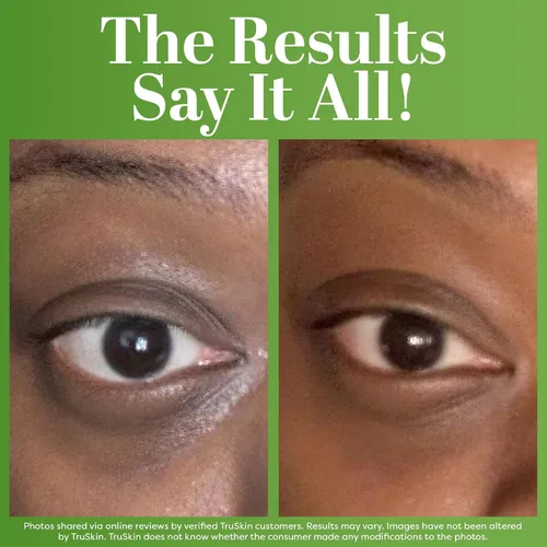 Vista 4 de Gel de tratamiento para la piel Best Eye, para bolsas, arrugas, líneas de expresión, hinchazón y zonas oscuras, 100% natural, 75% orgánico