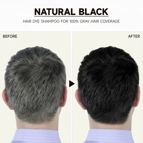 Vista 6 de IIIMEIDU 10 champú de tinte para el cabello para mujeres y hombres, champú de color 3 en 1, hierbas naturales para cobertura de cabello gris (negro)