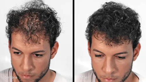 Vista 2 de Fibras capilares voluminizadoras con queratina real para adelgazar el cabello/pérdida de cabello – Dermatológicamente probado y certificado