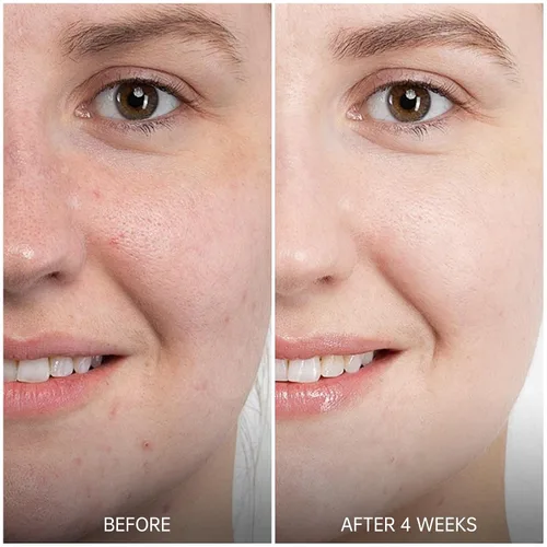 Vista 2 de VGO Suero de retinol para cara, suero de retinol rejuvenecedor con ácido hialurónico, niacinamida y ceramidas, hidratante y refrescante, suavizante