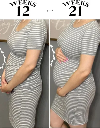 Vista 4 de Liu & Qu - Vestido de maternidad para mujer, de manga corta o manga 34, fruncido, para uso diario o baby shower