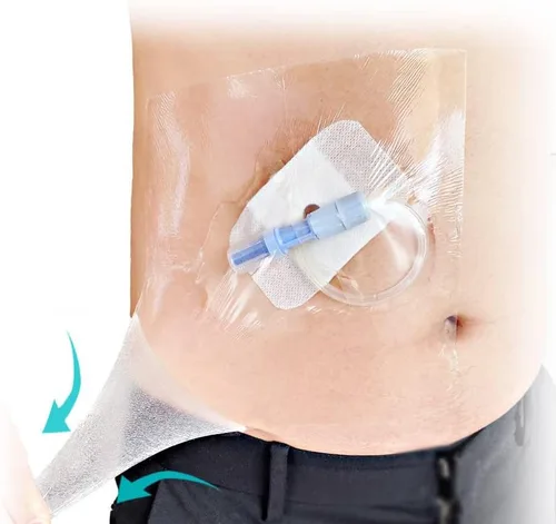 Vista 3 de Funda de ducha impermeable para bolsa de ostomía, 30 piezas de película protectora de baño de estoma, vendaje adhesivo (3.93 x 4.72 pulgadas)