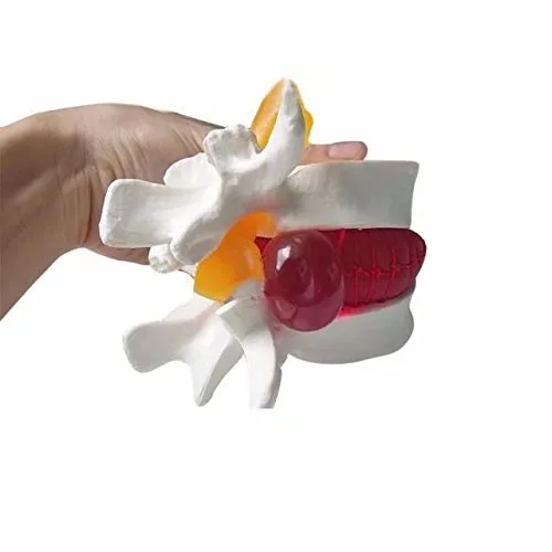 Vista 6 de DENTAL Color blanco oral 1:1.5 vértebras lumbares humanas anatómicas degenerativas lumbares modelo de columna vertebral humana US Stock