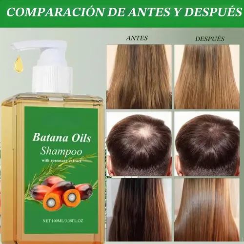 Vista 5 de 2 champús de aceite de batana, champú de aceite de romero, 100% aceite de batana con extracto de romero, champús de batana para la caida