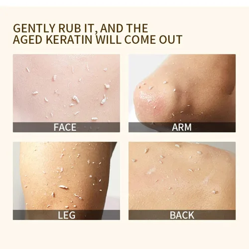 Vista 3 de 2 unidades de gel exfoliante naranja para cara y cuerpo, exfoliante de limpieza profunda de poros para eliminar puntos negros, hidratante y suave