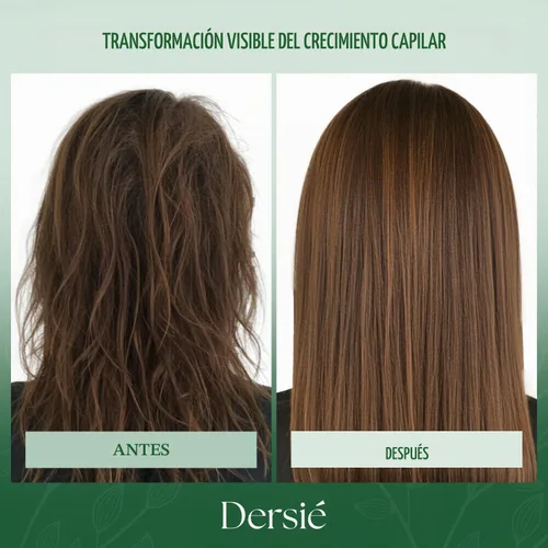 Vista 5 de Dersie Acondicionador de aceite Batana (10 fl oz)