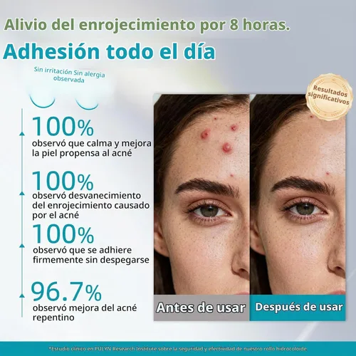 Vista 4 de Dimora Rollo de vendaje hidrocoloide de grado médico (2 pulgadas x 16 pies), apósitos hidrocoloides altamente absorbentes para el cuidado