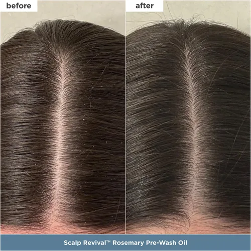 Vista 5 de Briogeo Healthy Hair Delights - Kit de regalo de reparación de cabello limpio para todo tipo de cabello, máscara de acondicionamiento profundo
