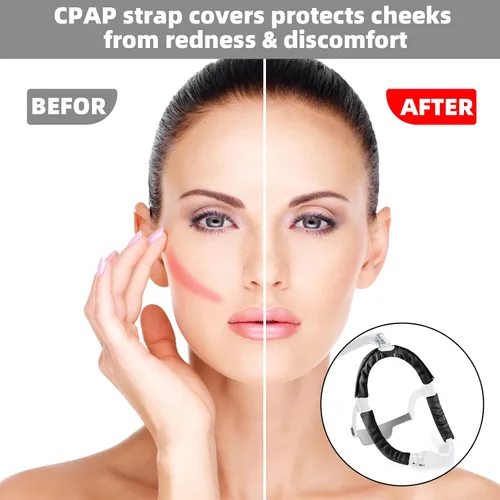 Vista 3 de Paquete de 3 fundas de correa CPAP de satén suave, protector de cabello CPAP para mujer, universal y cómodo, para correas de máscara CPAP Dreamwear