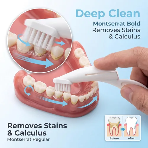 Vista 4 de Cepillo de dientes para perros y gatos, cerdas de nailon suave, cepillo de dientes de dedo de gato con mango ergonómico, cepillo de dientes