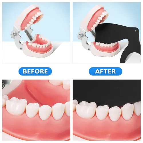Vista 7 de PROTECTOR Kit de contraste de fotos dentales de 6 piezas de contratista dental fotográfico dental negro