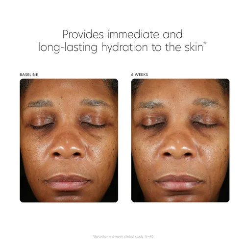 Vista 7 de PCA SKIN Suero facial potenciador de ácido hialurónico, suero de ácido hialurónico para la cara hecho con niacinamida y ceramidas, ayuda a reducir