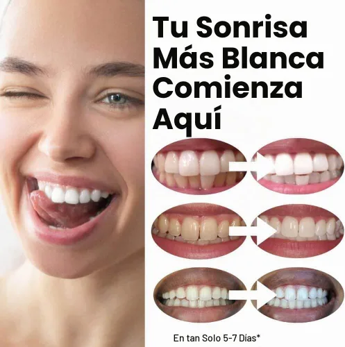 Vista 5 de Flexfit™ Bandejas blanqueadoras de dientes precargadas - Blanqueador dental profesional con peróxido de hidrógeno al 12%, tecnología Dryfit™ lista