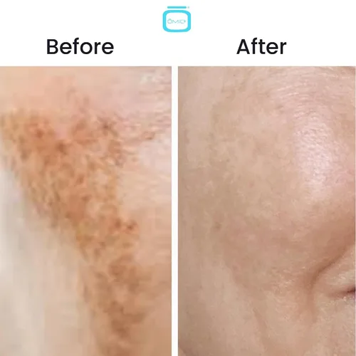 Vista 3 de OMIC Crema 10% de ácido tranexámico – 1 onza líquida / 1.0 fl oz – Crema iluminadora de la piel, reduce la apariencia de manchas oscuras, hidratante