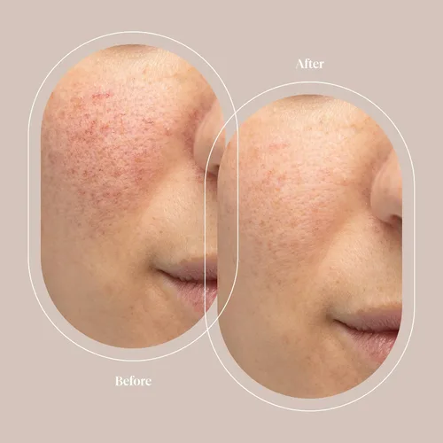 Vista 4 de Trophy Skin JeNu Marine Collagen Mineral Gel - Suero de gel para el cuidado de la piel con colágeno hidrolizado y ácido hialurónico, cuidado