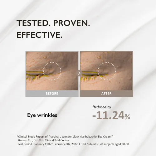 Vista 6 de Crema de ojos de arroz negro Bakuchiol Haruharu Wonder 0.67 fl.oz / 20ml Antienvejecimiento, cuidado de arrugas, alternativa natural al retinol