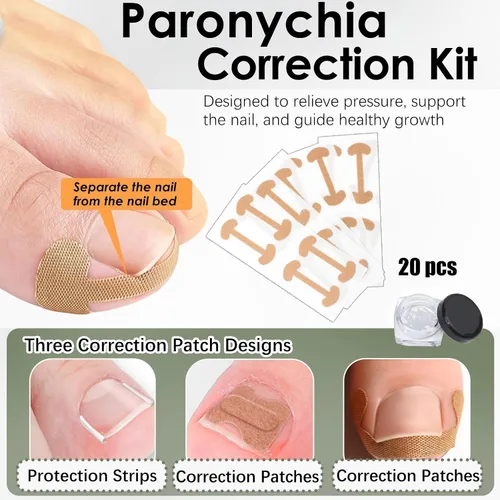Vista 2 de Juego de corrector de uñas encarnadas, kit profesional de tratamiento de uñas encarnadas con tiras de corrección transpirables, parches curvos