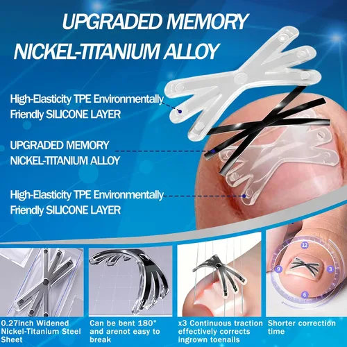 Vista 2 de Tratamiento de uñas encarnadas con forma mejorada de 6 ángulos, corrector de uñas encarnadas de aleación de titanio para un alivio rápido, kit