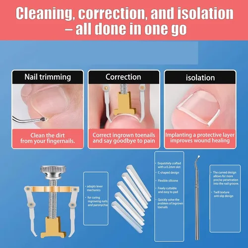 Vista 4 de Corrector profesional de uñas encarnadas para un alivio rápido con tiras transpirables de uñas encarnadas, herramientas de pedicura de acero