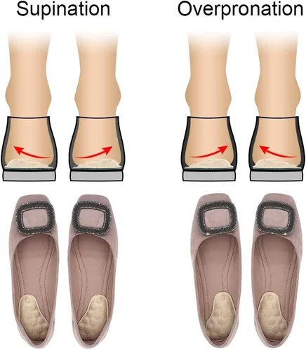 Vista 2 de Dr. Foot's - Plantillas correctivas de supinación y sobrepronación para zapatos, plantillas de cuña de talón medial y lateral para alineación