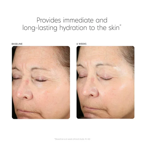 Vista 5 de PCA SKIN Suero facial potenciador de ácido hialurónico, suero de ácido hialurónico para la cara hecho con niacinamida y ceramidas, ayuda a reducir