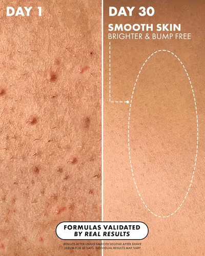 Vista 3 de Truly Suero para después del afeitado Beauty Smooth Legend Reduce