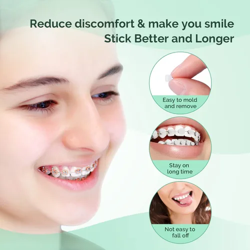Vista 4 de JMU Cera ortodóntica para brackets - Sabor menta (50 puntos precortados), Cera dental para brackets, Fácil aplicación para adultos y adolescentes