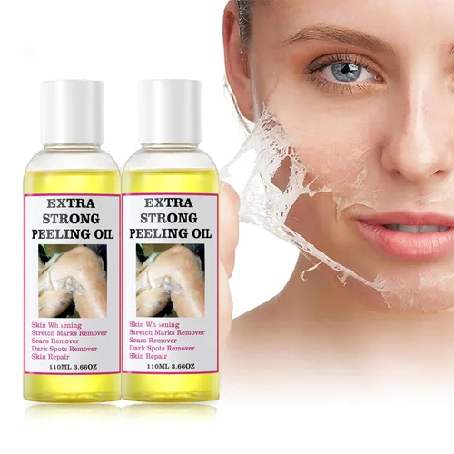Vista 9 de Aceite de pelado químico extra fuerte amarillo, aceite químico para piel oscura, solución exfoliante para el cuerpo, todo tipo de piel, 3.7 fl