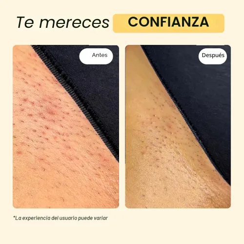 Vista 5 de MyMagicHealer Cuidado de Brotes de Tomillo y Árbol de Té Cabello encarnado, protuberancias de afeitar, espinillas ciegas, bartolín, quistes