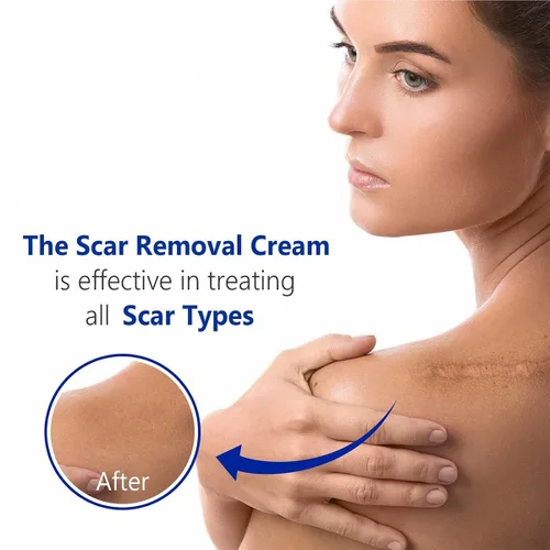 Vista 5 de Gel avanzado para cicatrices quirúrgicas, cara, cuerpo, piernas, quemaduras, acné, cesárea, estrías, queloides, eliminación eficaz de cicatrices