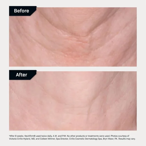 Vista 6 de Revision Skincare Nectifirm®, Crema reafirmante antienvejecimiento para el cuello para reducir líneas finas, arrugas y piel crepey