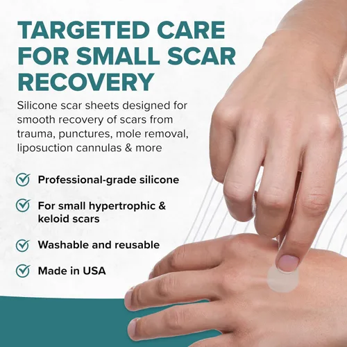 Vista 2 de Epi-Derm Epi-Tab Circles - Láminas de silicona para cicatrices – Parches de silicona lavables y reutilizables de grado profesional, para pequeñas