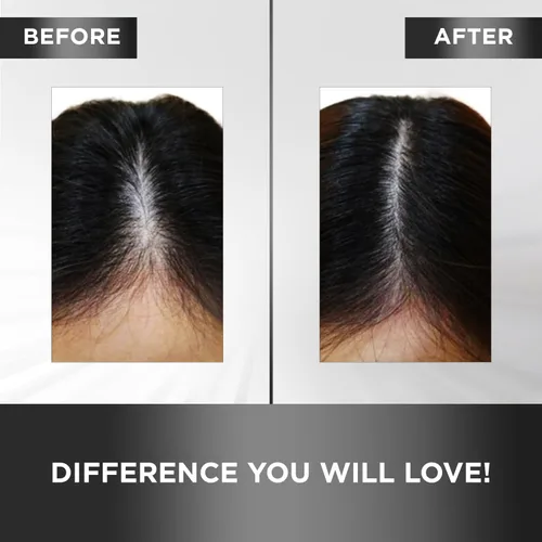 Vista 4 de MOEHAIR Tónico capilar Mejora la salud del cuero cabelludo y el cabello Estimula los folículos Tónico voluminizador Infundido con aceite